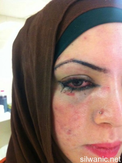 انوار ابو رموز