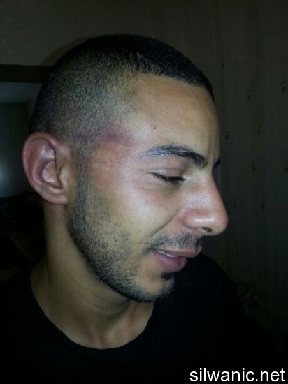 محمد قضماني 1