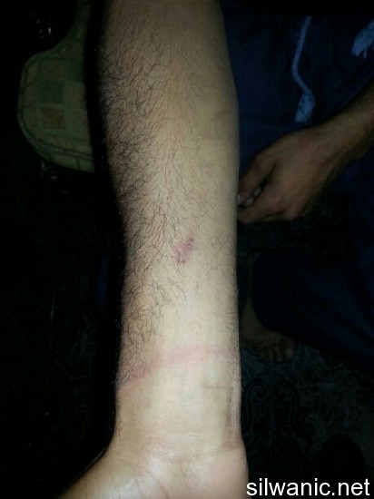 محمد قضماني 2