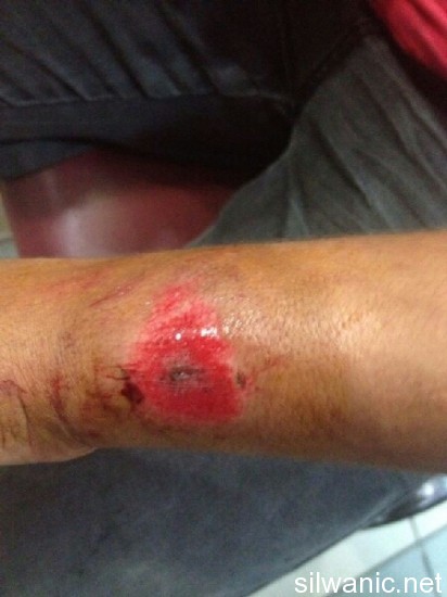 image-1375735722045-V