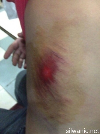 image-1375735736809-V