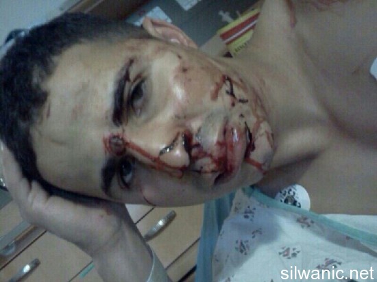 هشام العباسي2