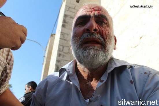 11201890_810780855702681_7708434269538871018_n