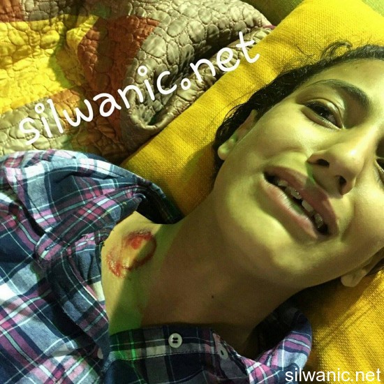 سالي اصابة عيسية